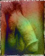 Therapie